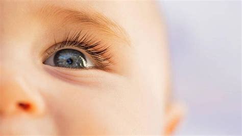 bebeklerde göz altı morarması neyin belirtisi